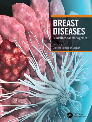 cover image of Breast Diseases
